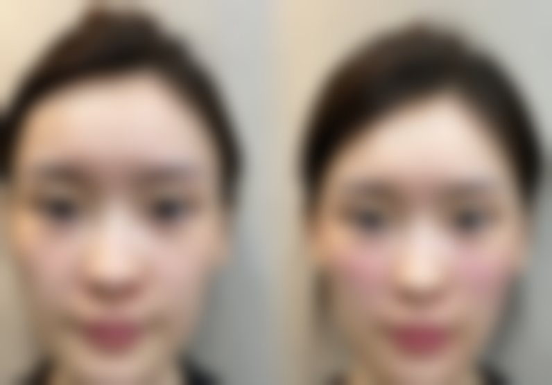 宁波壹加壹美容整形医院价格收费