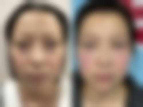 海南优嘉舒颜医疗美容诊所价格收费