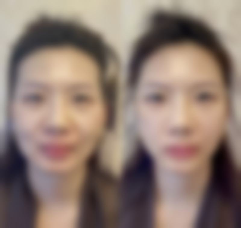 深圳唯美星医疗美容医院价格收费