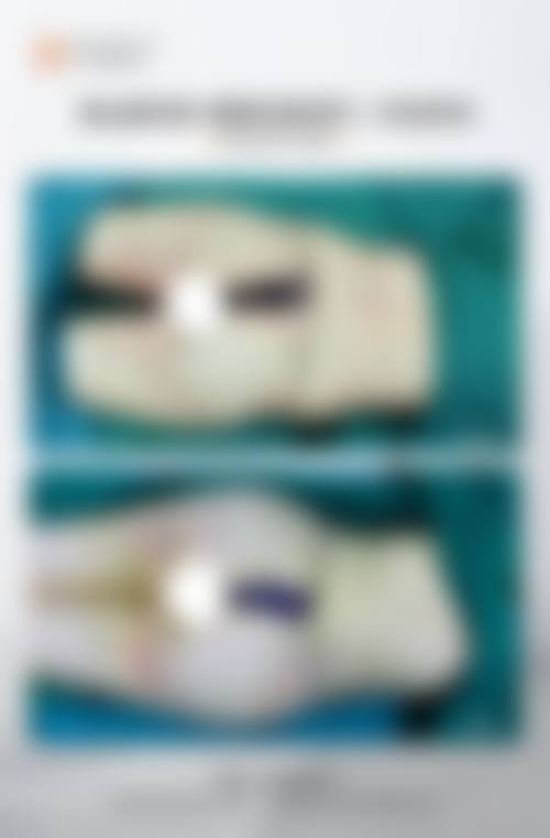 朱巧凤医生部分医美项目价格参考