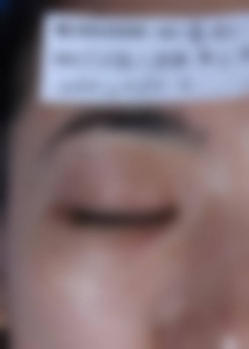 朱巧凤医生的个性化审美与诊疗思路