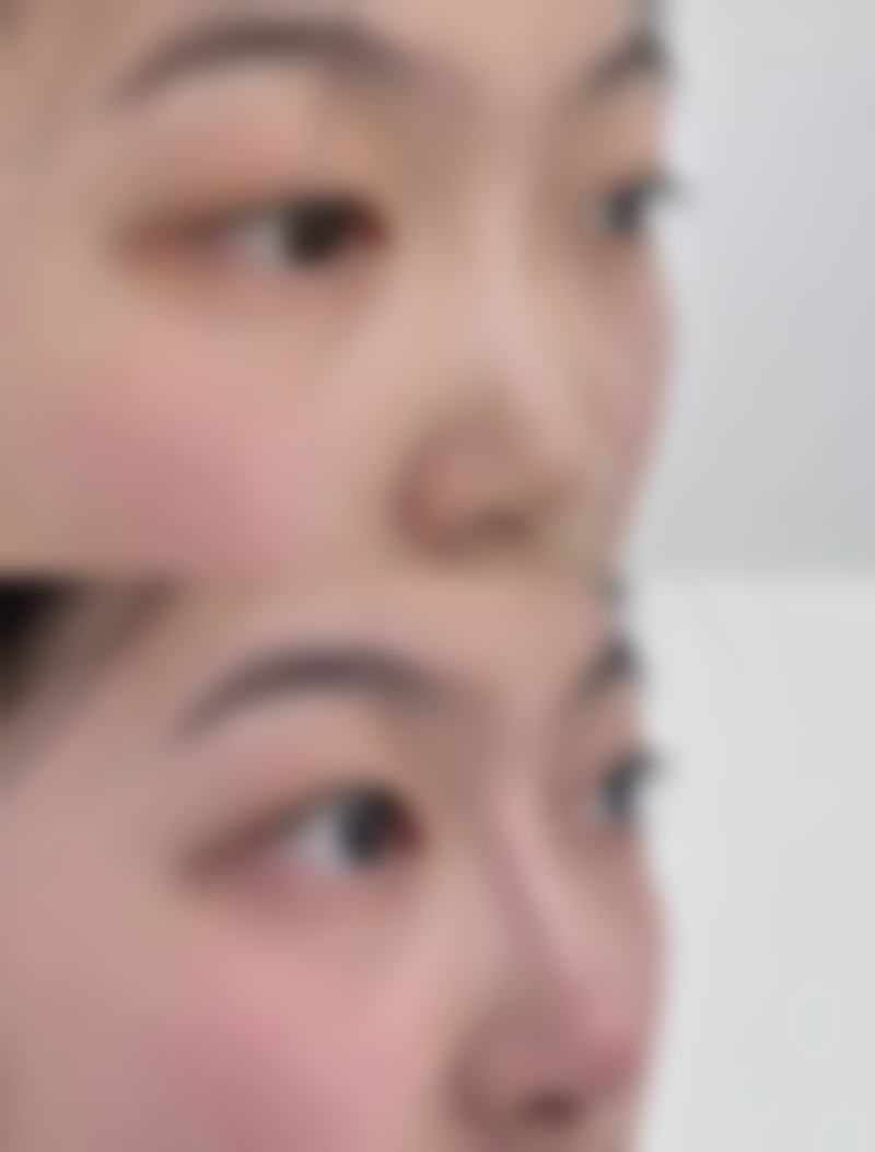 张家界逸韩整形美容医院求美者反馈