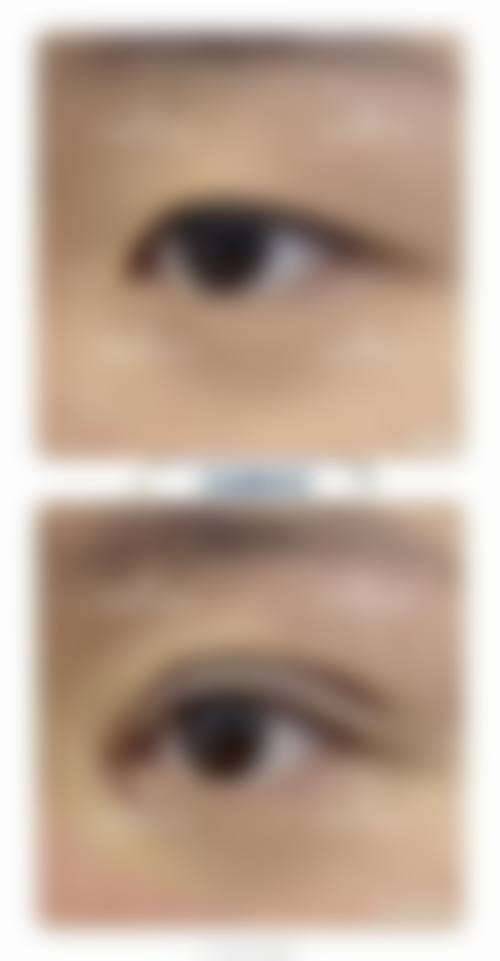 长沙三和医疗美容整形医院求美者反馈