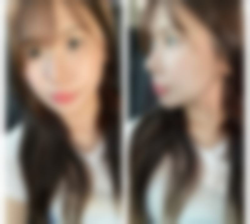 韩国Noblesse整形外科简介概述