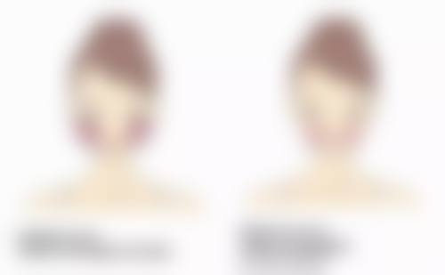 叶伊琳医生：依托韩美高端设备保护诊疗成效