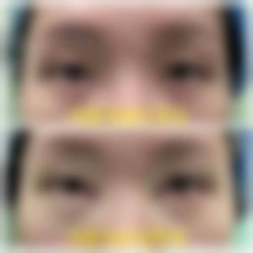 李梅医生的安心医美服务流程