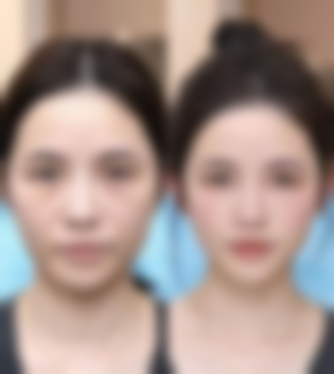 孟宪坤领衔的多领域医美项目：覆盖眼部、鼻部、胸部等核心整形需求