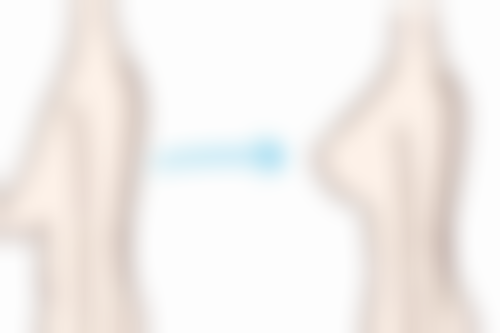 广西医 科 大学第一附属医院求美者反馈