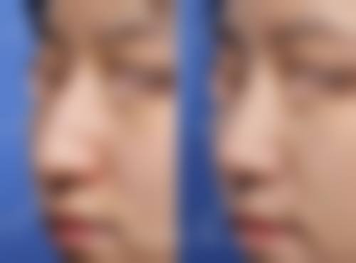 杭州丽欣医疗美容医院价格收费