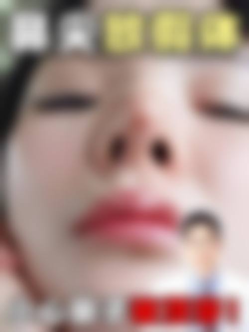 陈建璋医生的个性化医美服务理念