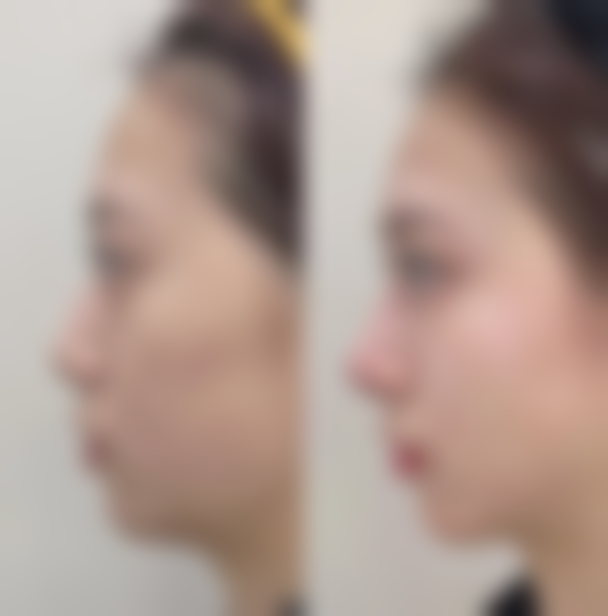 韩国清潭第一整形外科医院价格收费