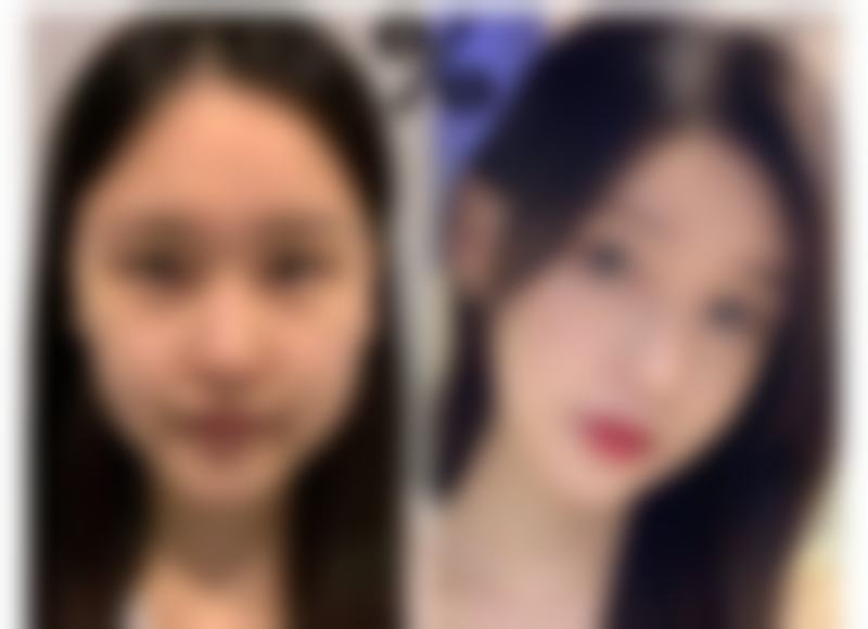 呼伦贝尔海拉尔董海杰医疗美容诊所特色项目及技术优势