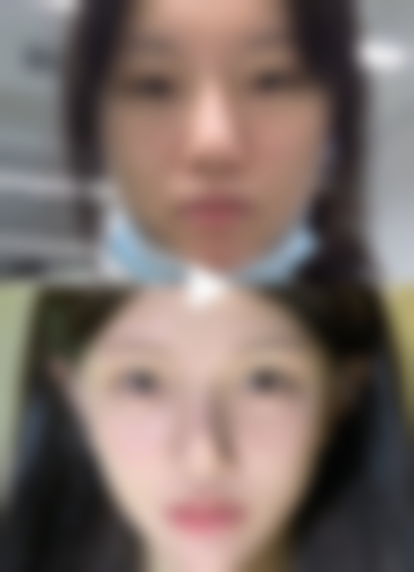 韩国若富丽提整形医院求美者反馈