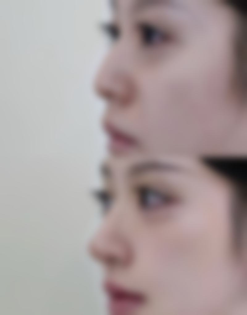 韩国若富丽提整形医院价格收费