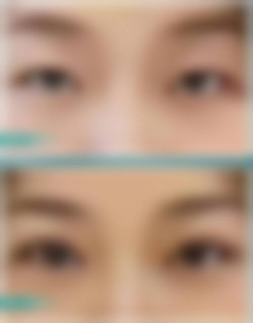 韩国新沙L整形外科价格收费