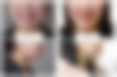 丁文蕴医生诊疗的正规技术与安心保护