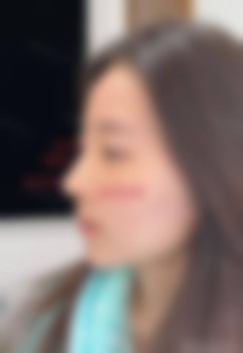 吴豫芳主治医师：依托无锡丽都专精医美平台保护安心与成效