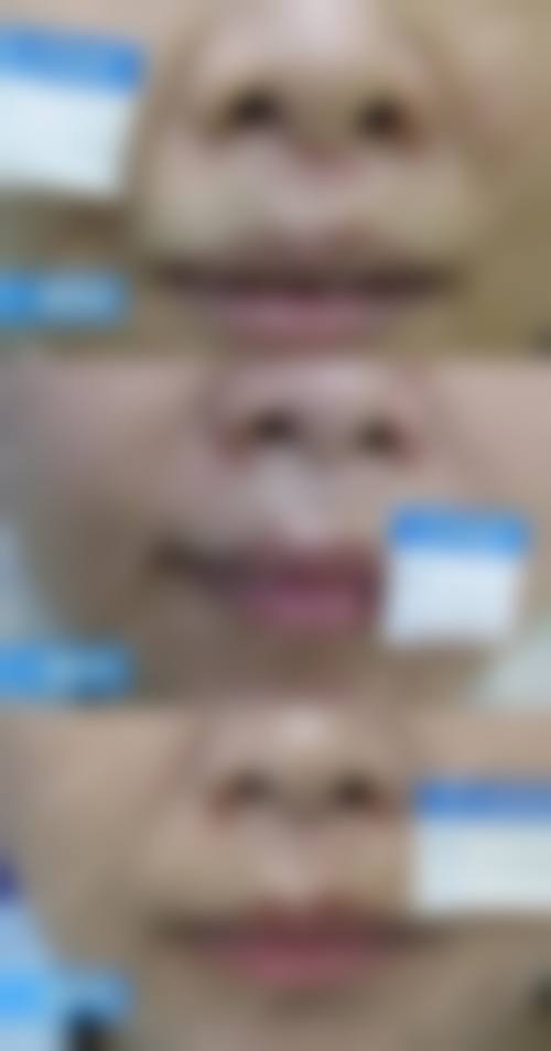 宝鸡皮肤病医院医生团队实力