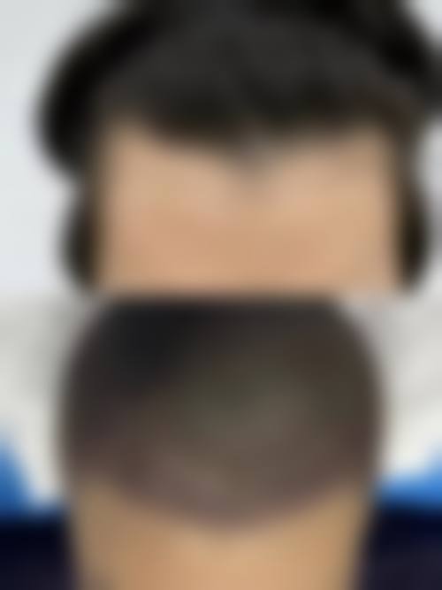 宝鸡皮肤病医院特色项目及技术优势