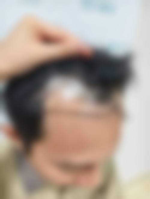 宝鸡皮肤病医院求美者反馈