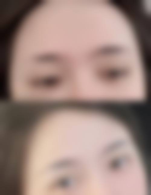 黄金振医生聚焦鼻整形领域，打造自然协调的术后成效