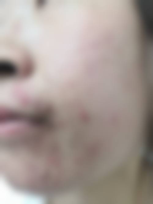 曹圭珉院长的个性化诊疗理念