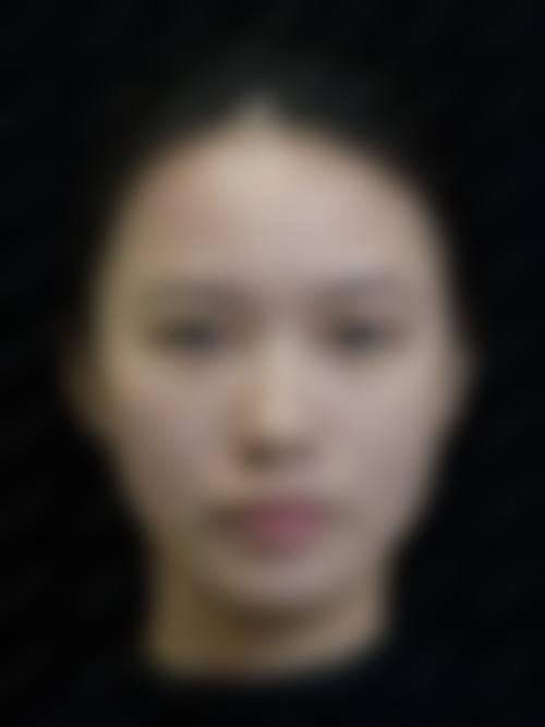 长沙卓恩整形医院价格收费