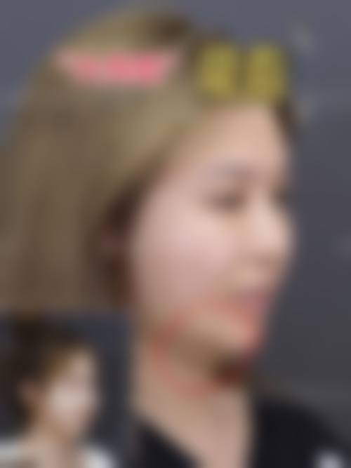 武汉名韩医疗美容门诊部求美者反馈