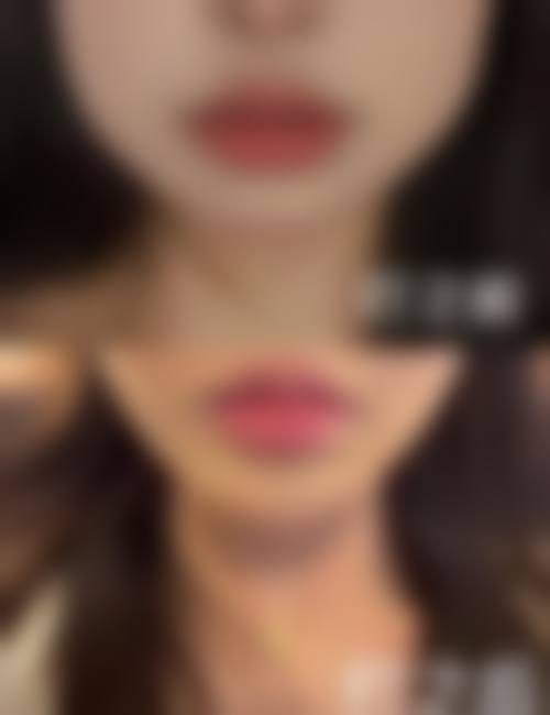 西安名一易美医疗美容诊所价格收费