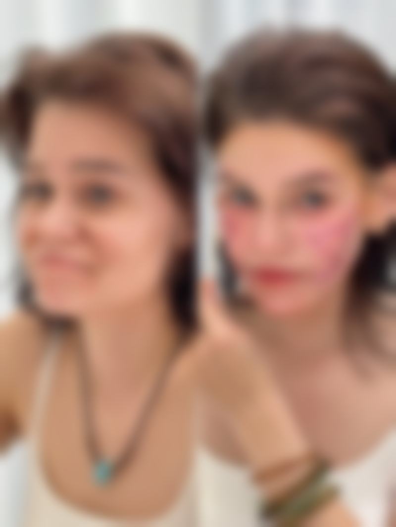 温州华悦（皇佳）医疗美容门诊特色项目及技术优势