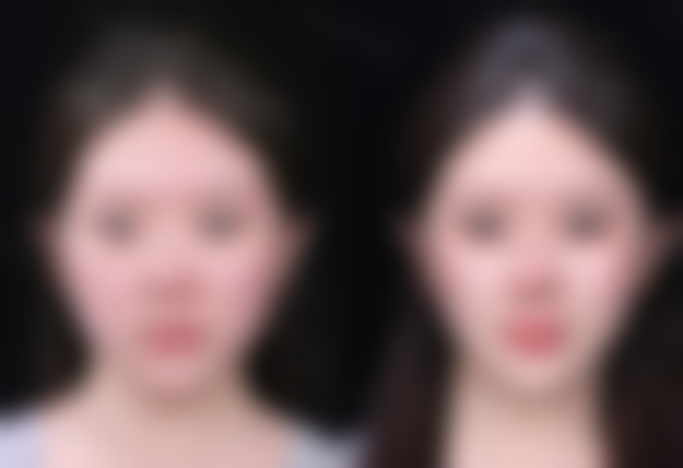 温州华悦（皇佳）医疗美容门诊价格收费