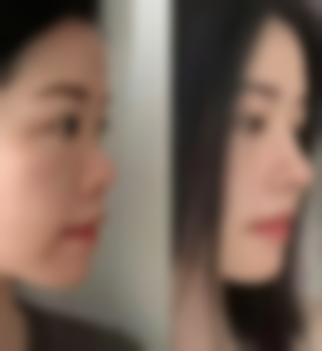 长沙卓恩整形医院求美者反馈