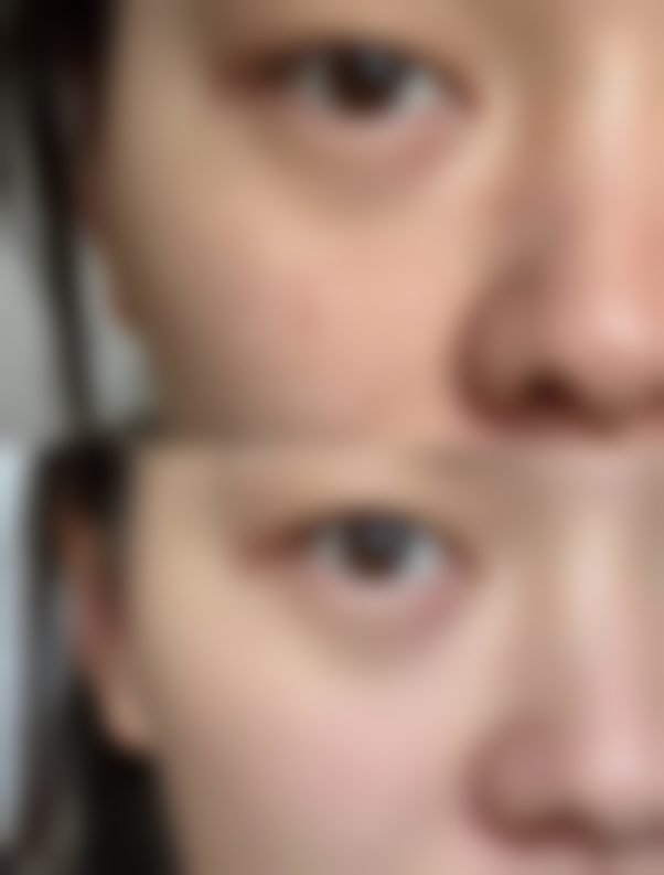 苏州云龙有美整形医院价格收费