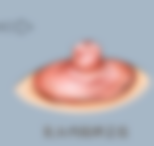 江南好眼睛眼科中医院求美者反馈