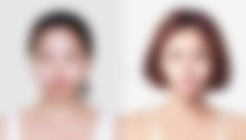 东北医院整形美容再生医学中 心价格收费