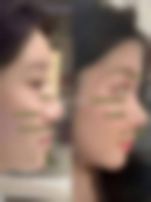 荆门佳美医疗美容诊所求美者反馈