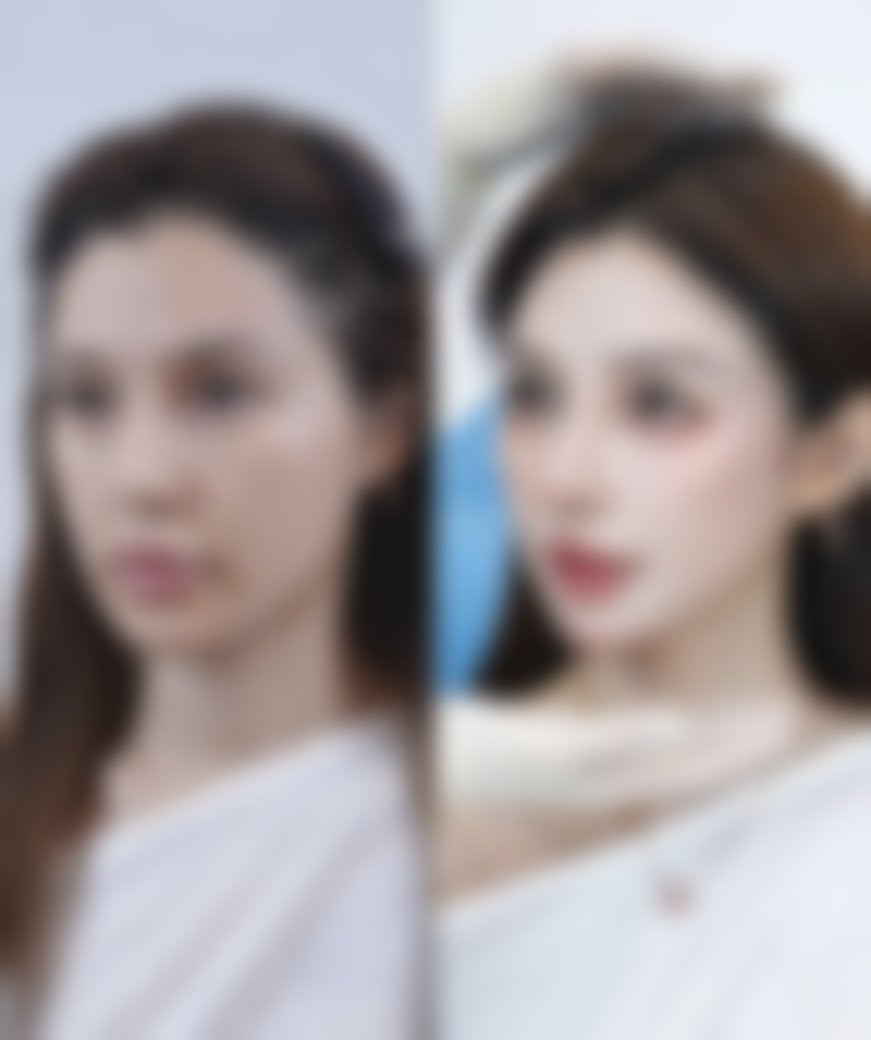 东北医院整形美容再生医学中 心特色项目及技术优势