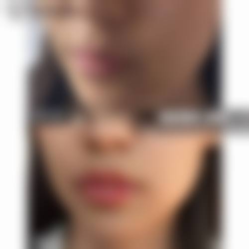 盘锦京韩整形美容医院价格收费