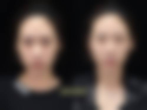 鞠孟然医生覆盖的全品类医美整形服务项目