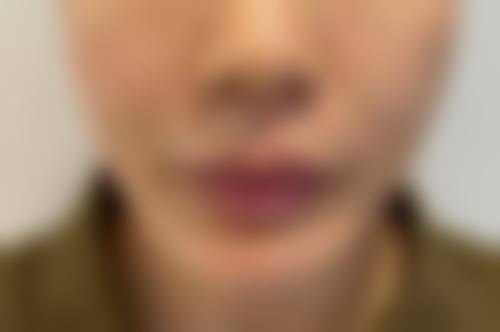 Dr.jins整形外科医生团队实力