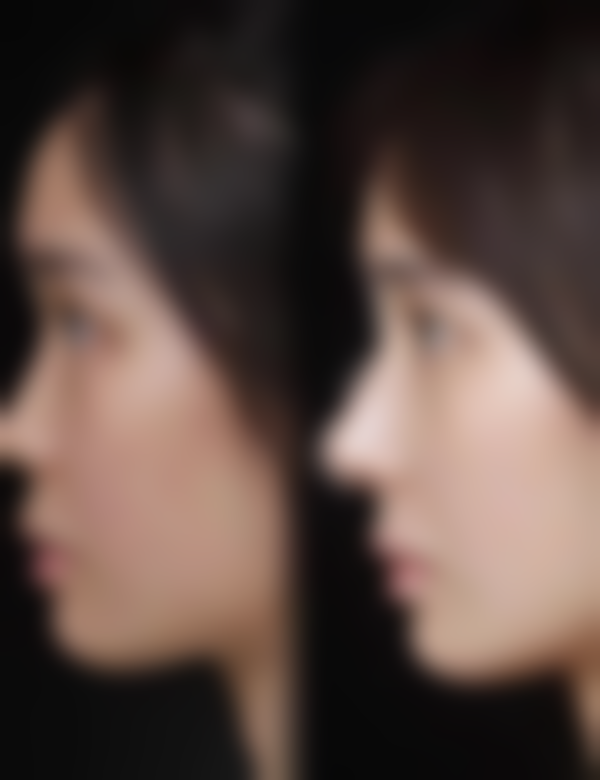 上海纽添整形医院来院路线