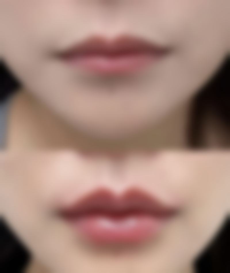 盘锦京韩整形美容医院特色项目及技术优势