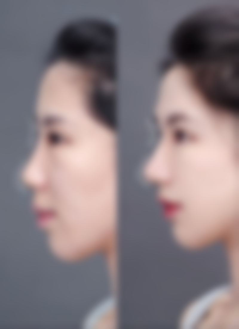 蒋炎春医生：以个性化方案匹配求美者需求