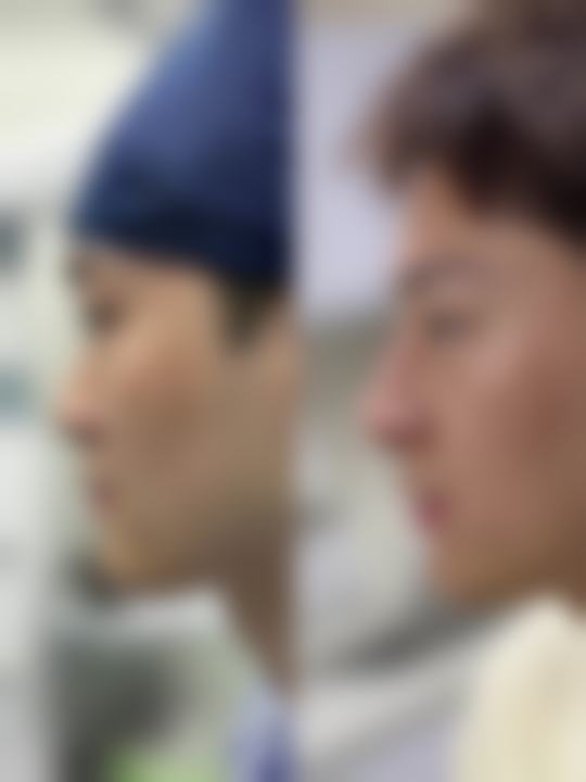 上海纽添整形医院价格收费