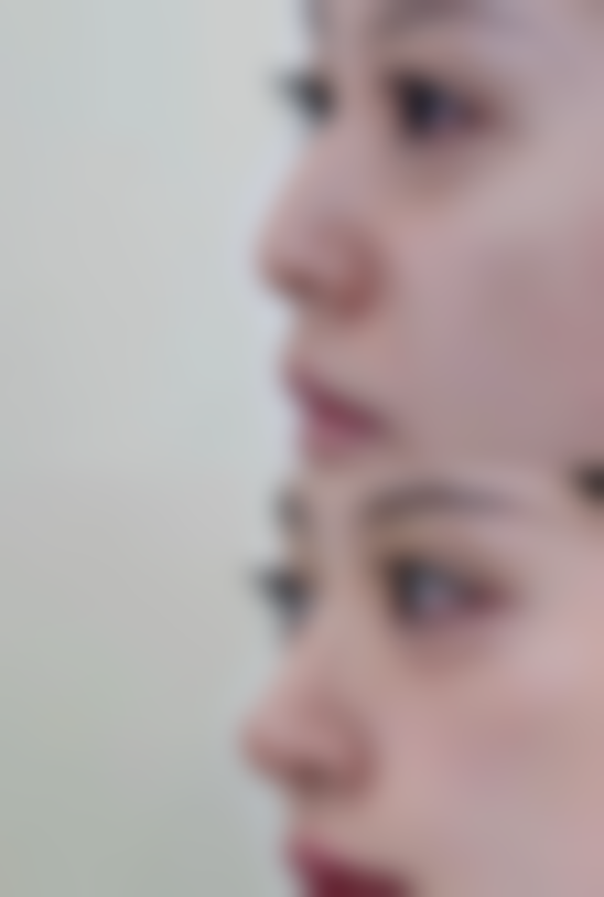 张胜利医生的个性化医美服务思路