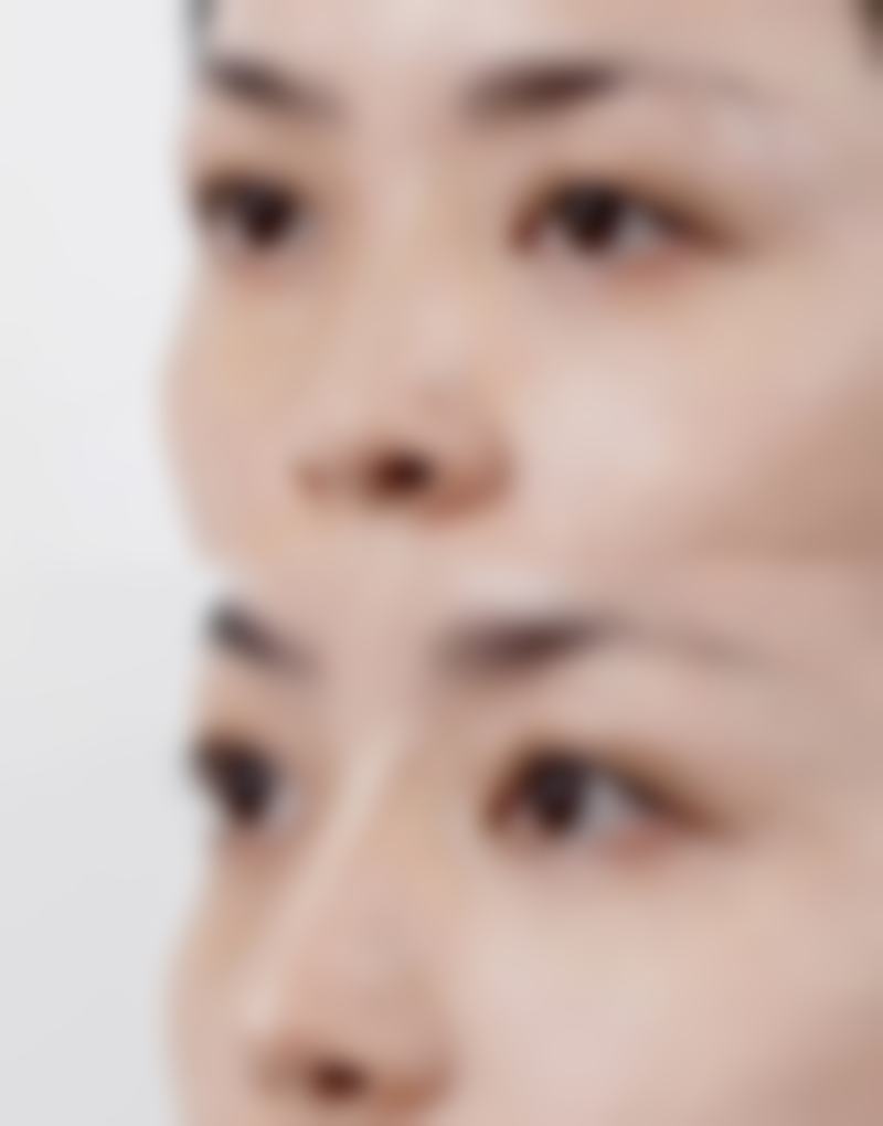 深圳江南春天医疗美容医院求美者反馈