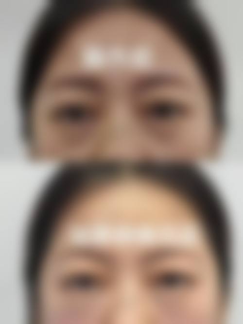 周碧君：坚守精细化医美理念的实践者