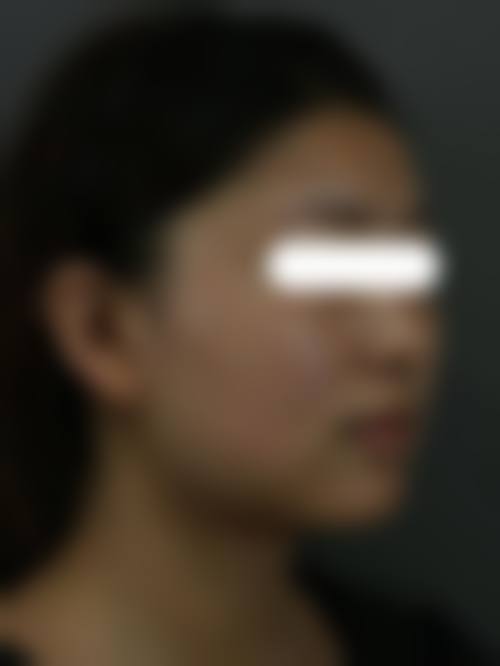 大庆龙南医疗整形美容诊所求美者反馈