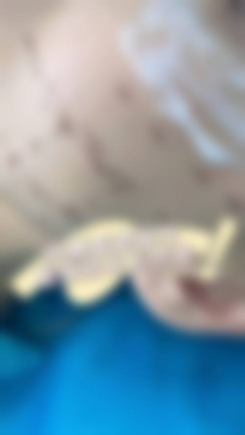 中川桂院长的特色技术优势