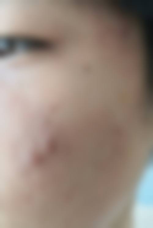 毕节市中医院价格收费